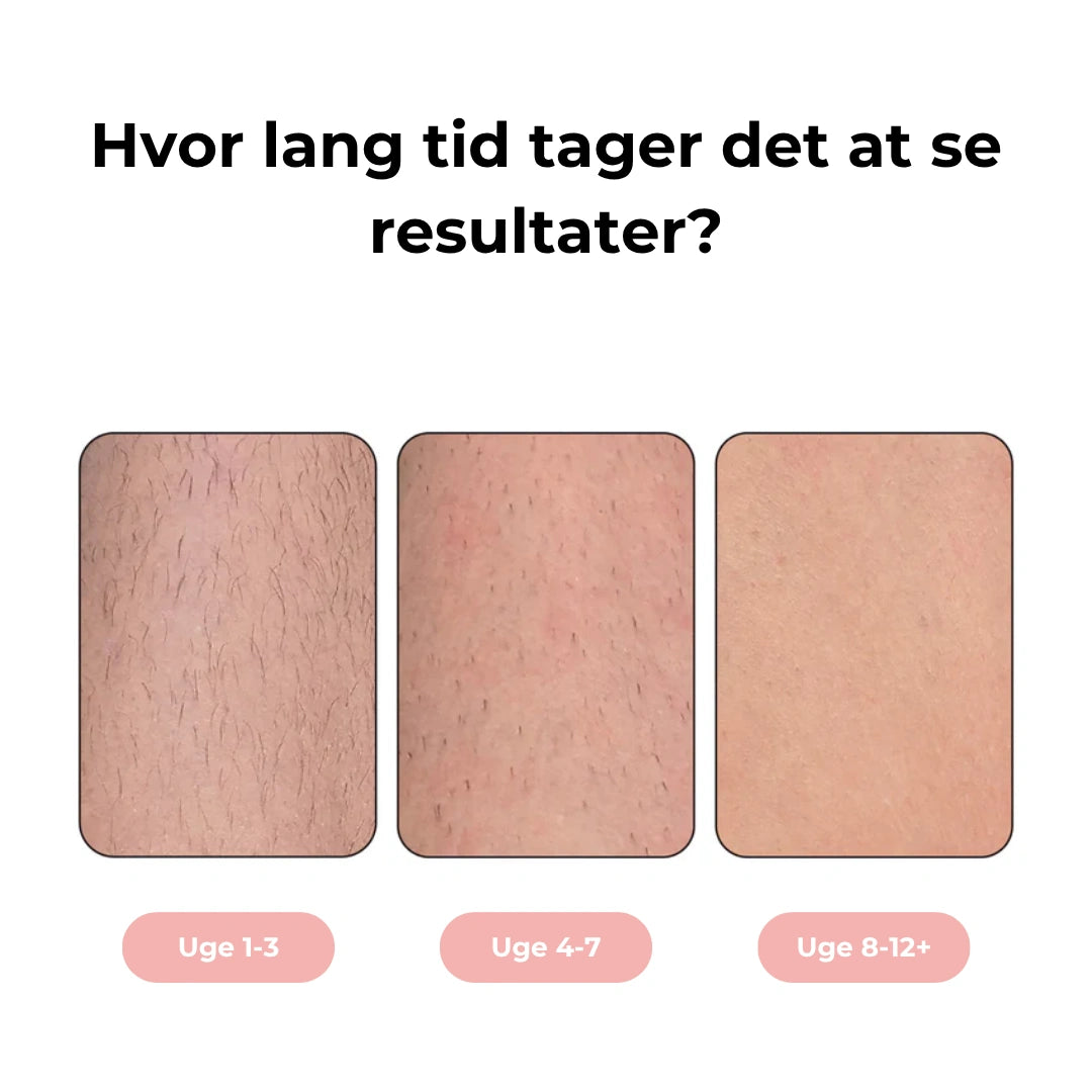 HairLess IPL – Permanent hårfjerning