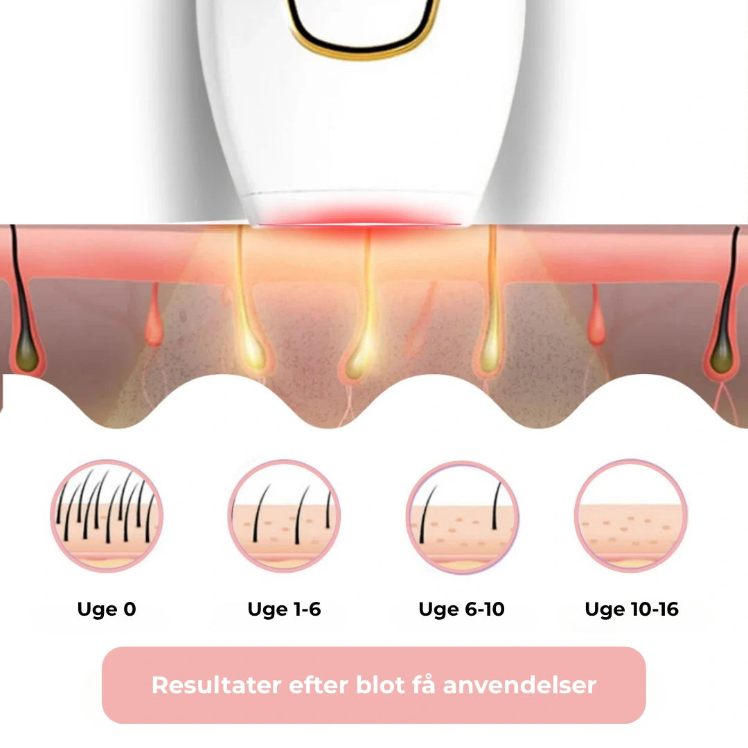 HairLess IPL – Permanent hårfjerning